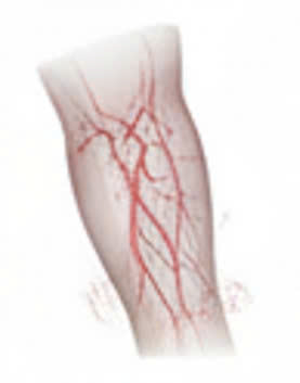 Tê bì chân tay, yếu nửa người