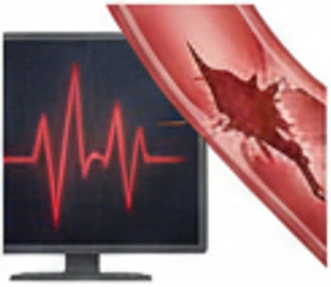 biểu đồ huyết áp